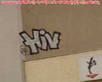 HIV
