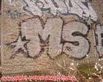 MS (MITTE)